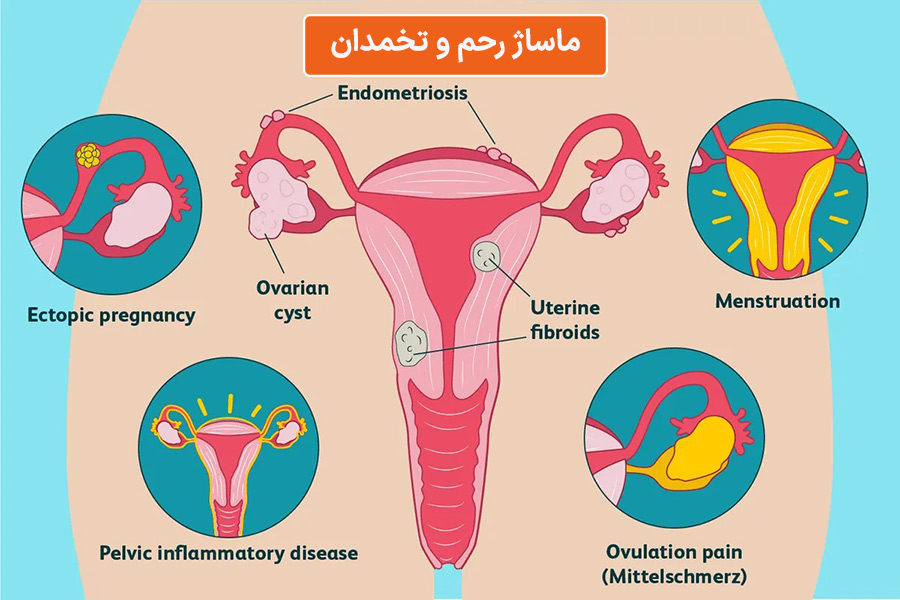 ovary ماساژ باروری
