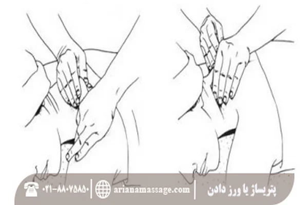پتریساژ یا ورز دادن