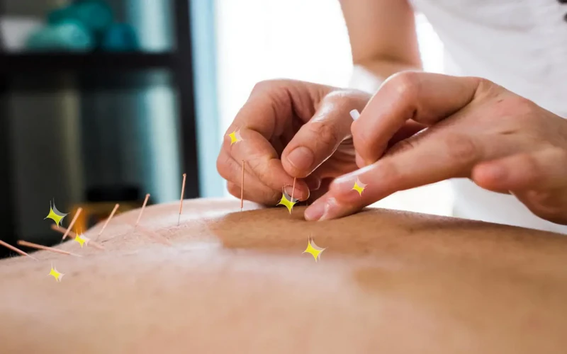 با طب سوزنی چند کیلو در ماه لاغر میشویم