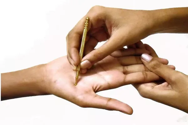 سوجوک تراپی چیست