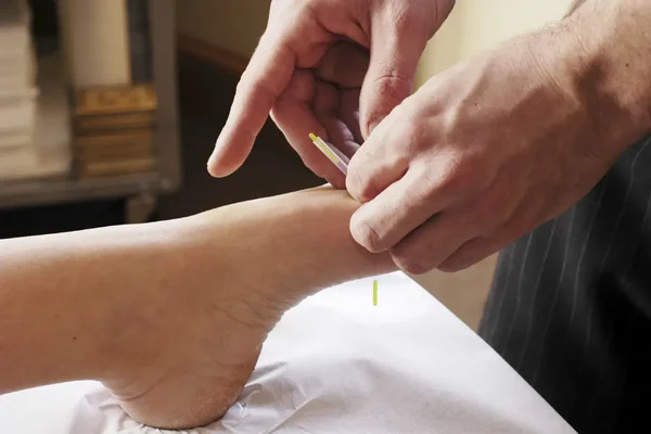 مراقبتهای بعد از طب سوزنی