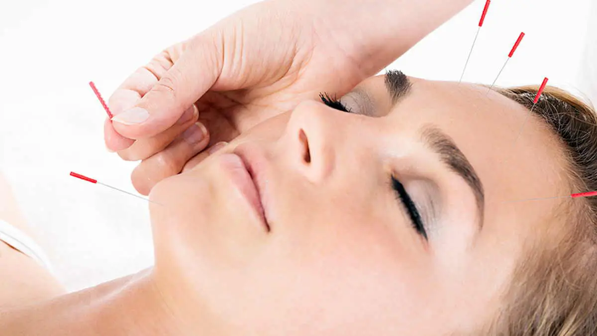 طب سوزنی گوش برای لاغری