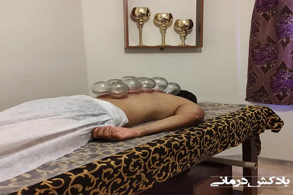 بادکش درمانی