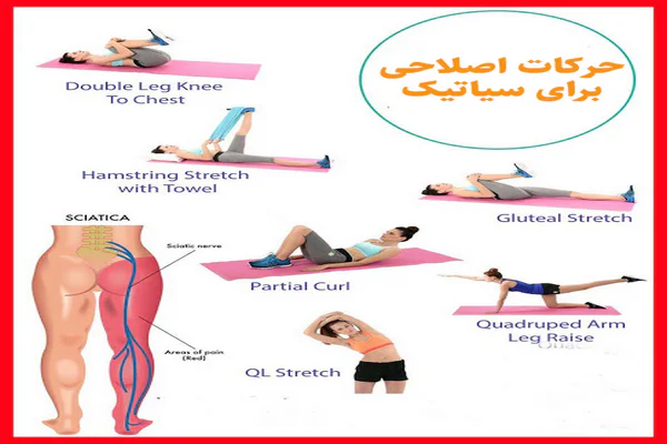 حرکات اصلاحی برای سیاتیک