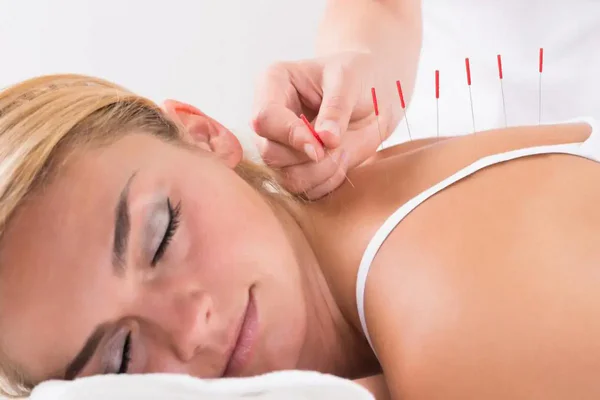 با طب سوزنی چند کیلو در ماه لاغر میشویم