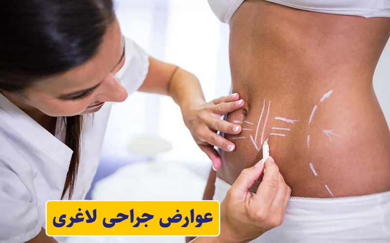 عوارض جراحی لاغری
